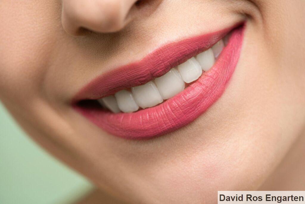Cómo poner implantes dentales