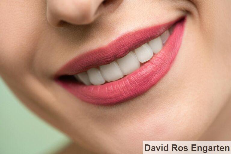 Cómo poner implantes dentales